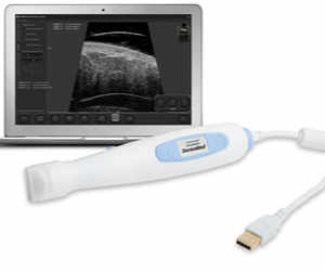 Ultrasound Scanner