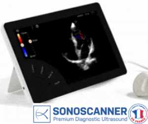 Ultraportable ultrasound scanner